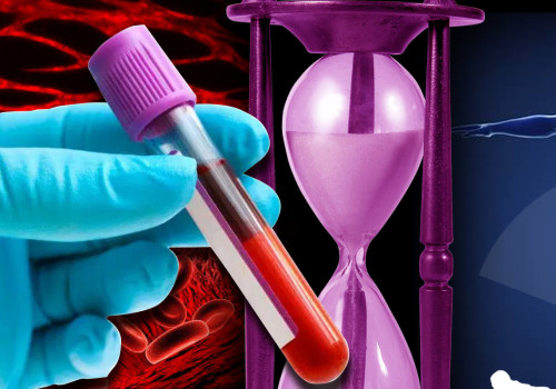 Does time of day matter for testosterone test?